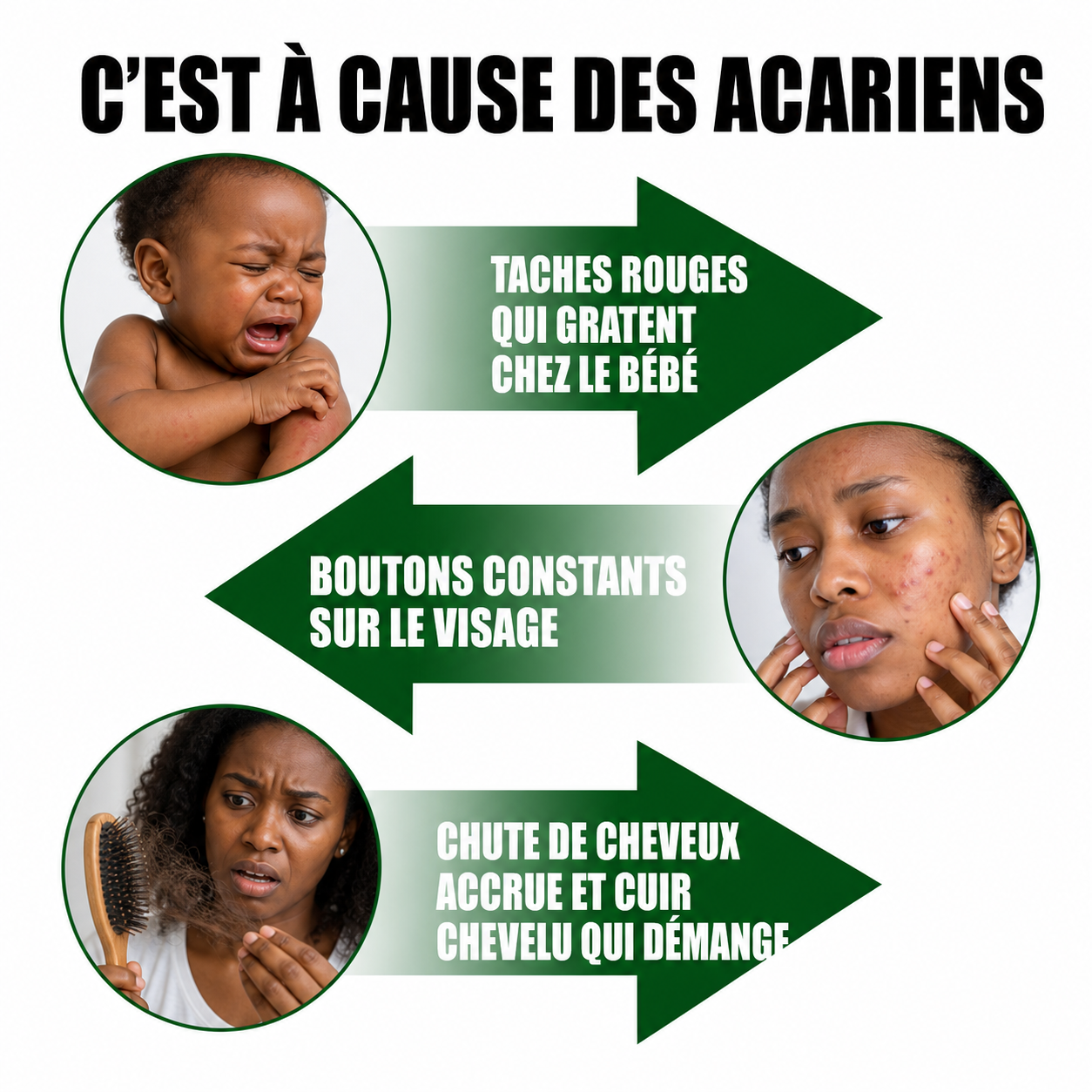 Spray Nettoyant Acariens de Maison (Couverture,Oreiller,...)🇧🇯